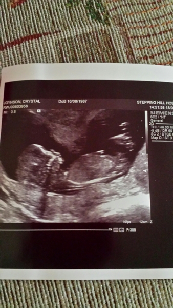 13 weeks anyone like to guess the gender