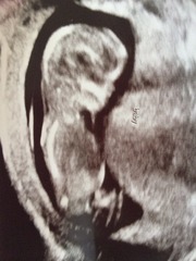 Scan pic ... Sex guesses