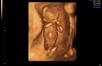 September 2015 (Thread 5) Bring on the scans! :)