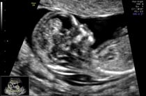 September 2015 (Thread 5) Bring on the scans! :)