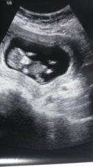 Boy or girl?