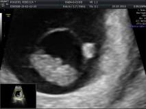 September 2015 (Thread 5) Bring on the scans! :)