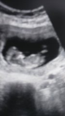 Boy or girl?