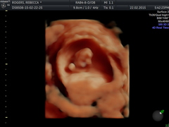 September 2015 (Thread 5) Bring on the scans! :)