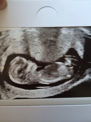Scan pic ... Sex guesses