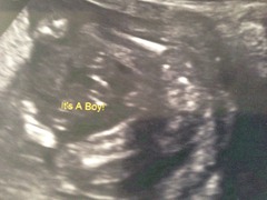 July 2015 - the thread in which bumps really start to appear...