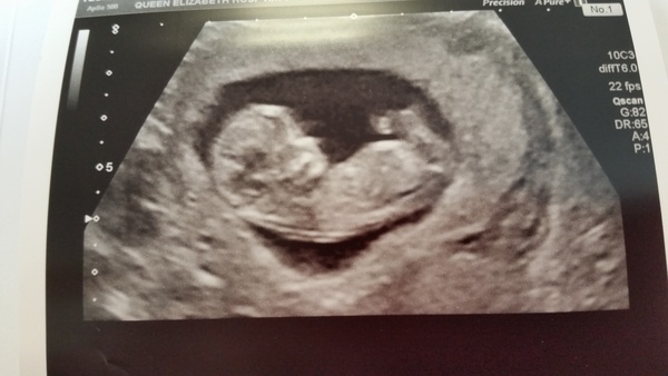 October baby bus take 3- booking in appointments and scans, here we come!