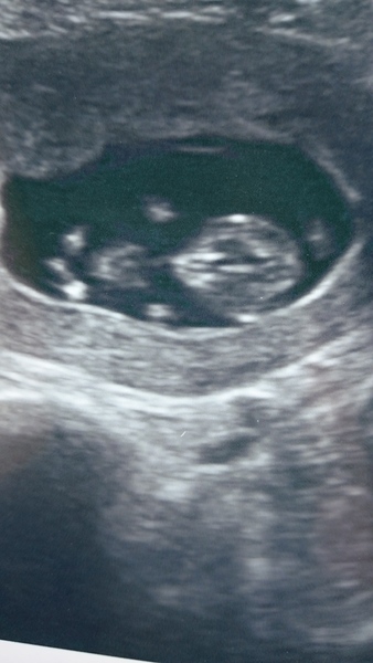 October baby bus take 3- booking in appointments and scans, here we come!