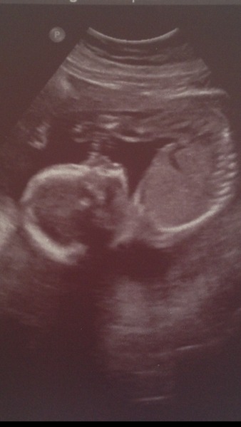 Gender guess anyone?