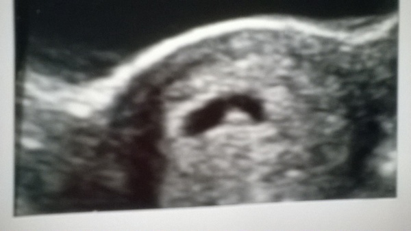 November 2015 - Turning BFPs into Babies!