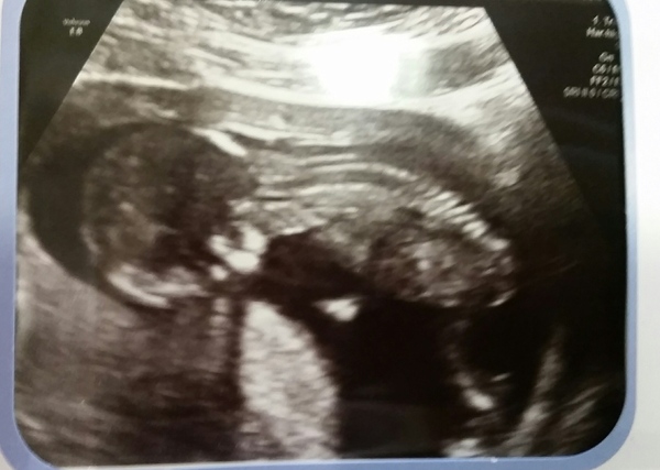 The due in September crew head into the second trimester! :) (Thread 6)