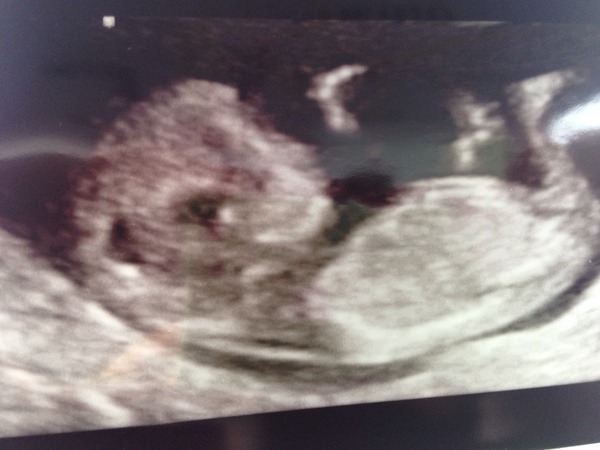 The due in September crew head into the second trimester! :) (Thread 6)