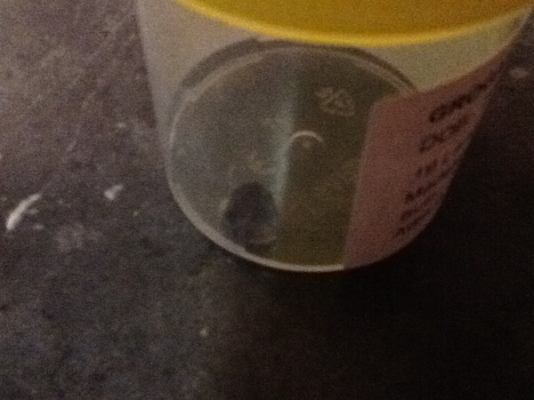 To not take DS(7) to A&E because he has a foil confetti star stuck up his nose