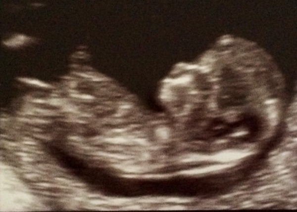 October baby bus take 3- booking in appointments and scans, here we come!