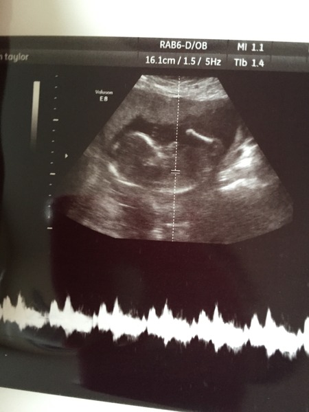 April TTC girls! Lots of babies being born! And the rest of us are gonna grab those BFP's!