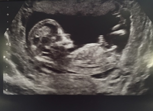 The due in September crew head into the second trimester! :) (Thread 6)