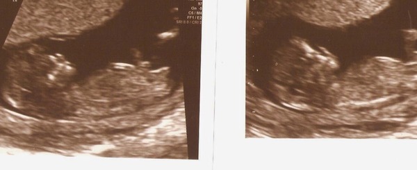 We're posifrickintive! Another posifrickintivity thread for pregnancy after miscarriage #2