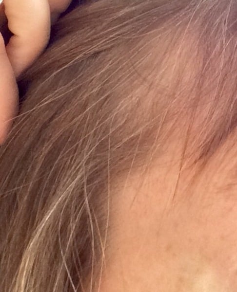 Greying at the temples