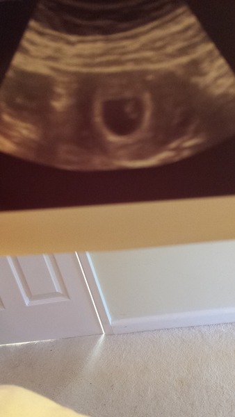 The best shit place to be grads - Early pregnancy after miscarriage - hopes and fears