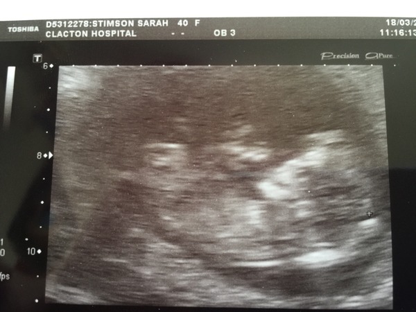 The due in September crew head into the second trimester! :) (Thread 6)