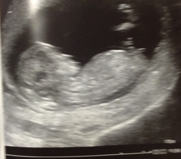 Can anyone whether it's a girl or boy with the skull theory?