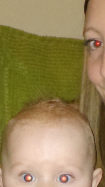 To worry this is retinoblastoma
