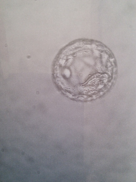 Recurrent Miscarriage Support Thread 20 - tests, treatment, trying again.