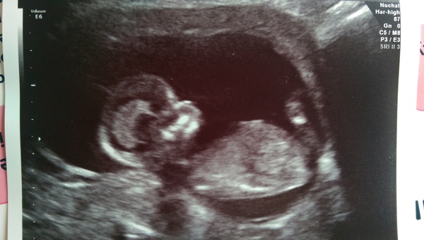 The due in September crew head into the second trimester! :) (Thread 6)