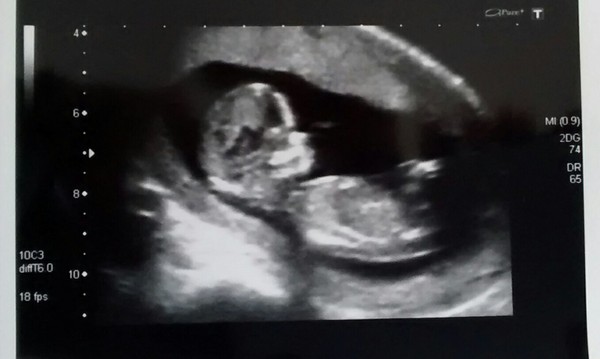 The due in September crew head into the second trimester! :) (Thread 6)