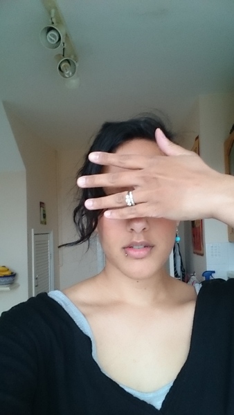 Has ipl worked for you if you have a darker skin tone (pic!)