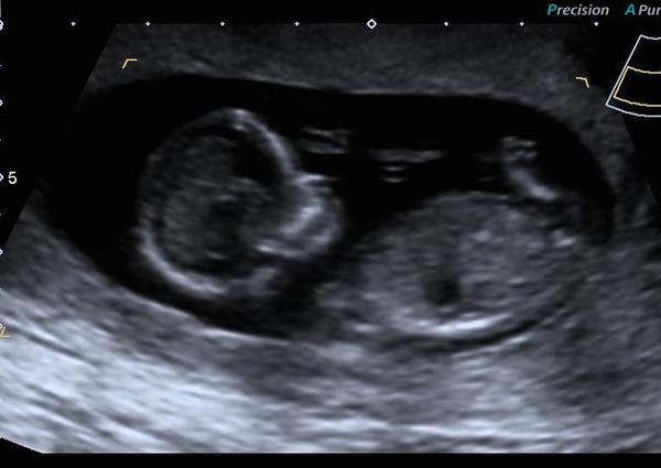 The due in September crew head into the second trimester! :) (Thread 6)