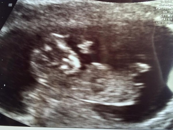 The due in September crew head into the second trimester! :) (Thread 6)