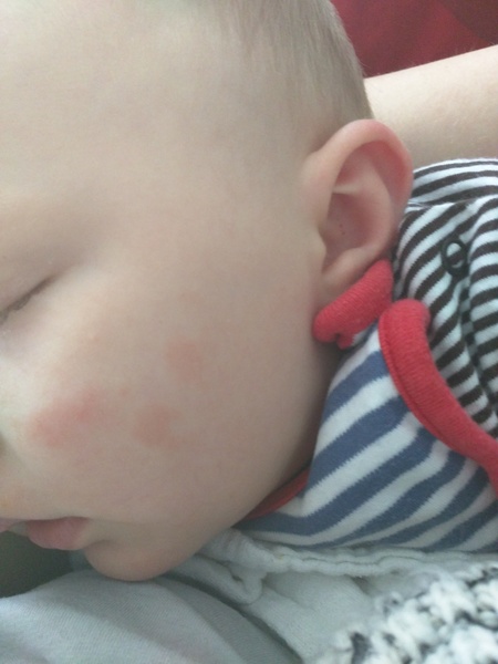 Can you identify this in my lo face?