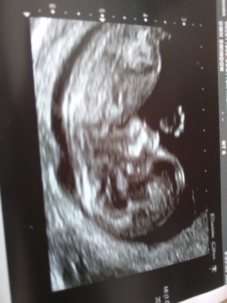 October baby bus take 3- booking in appointments and scans, here we come!