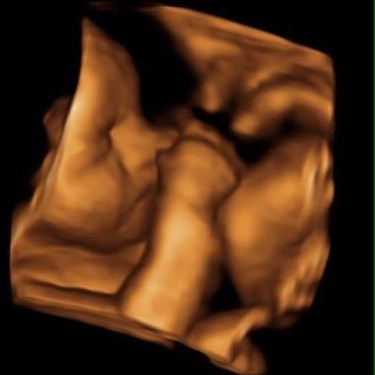 June 2015 - bumps ahoy!