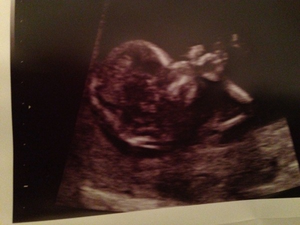 It's Spring, and the Old Birds are nesting. First hatchlings coming soon!