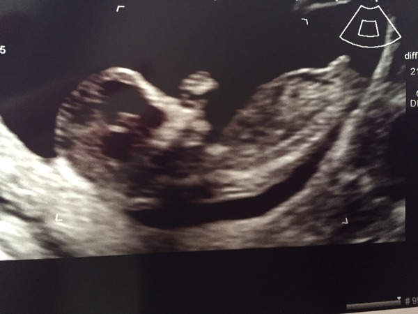 September 2015 (Thread 5) Bring on the scans! :)