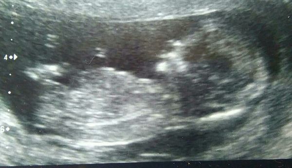 gender guess please ladies 13+1