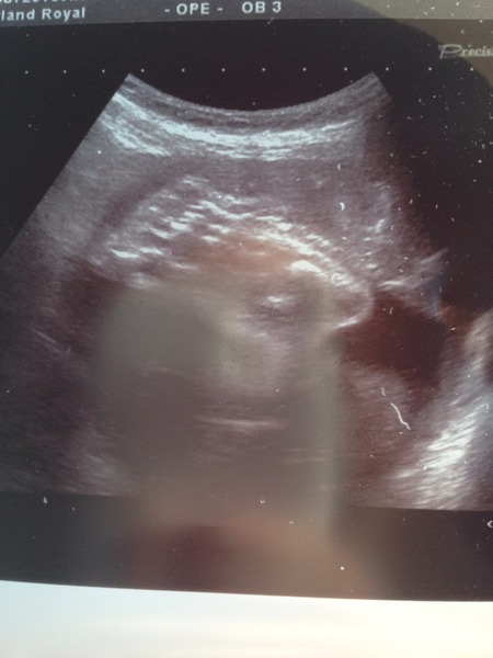 April 2015 Thread 12: Where are the carseats and are the bags packed, the babies are threatening to make an entrance!