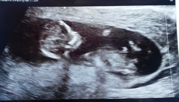 Can anyone whether it's a girl or boy with the skull theory?