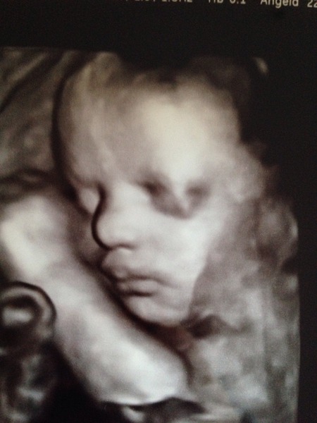 May 2015 - Thread 7 - As we enter the third trimester and count down to Maternity Leave!