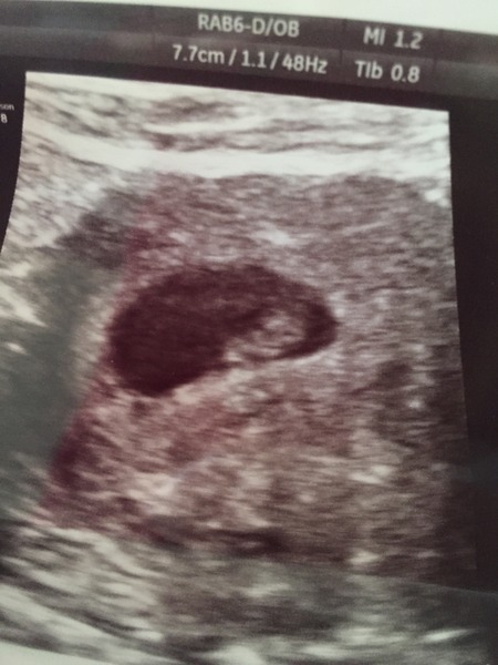 April TTC girls! Lots of babies being born! And the rest of us are gonna grab those BFP's!