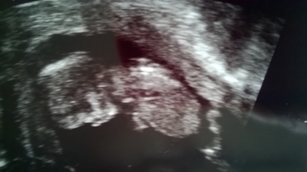 What the hell just happened to me? (poss gynae related?)