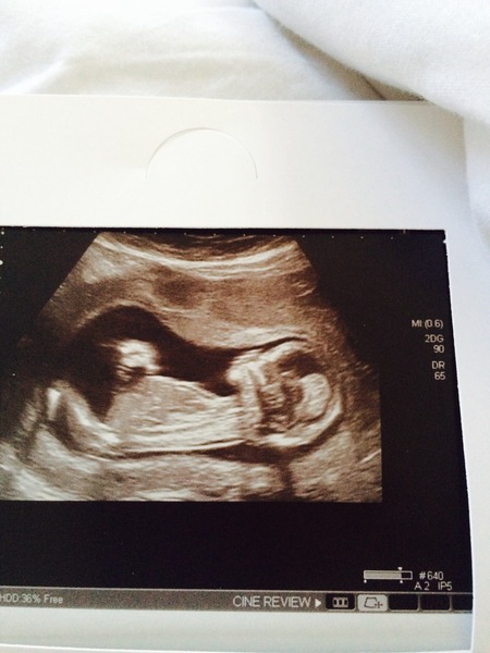 Girl or boy what do you think? TIA x