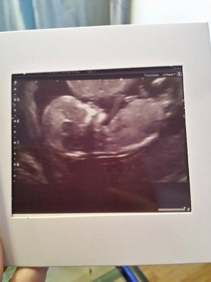 New to mumsnet. 3rd pregnancy, large age gap, scan included x