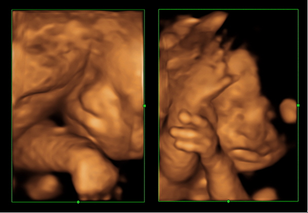 3D/4D scans