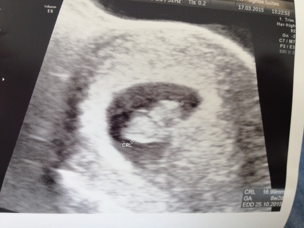 October baby bus take 3- booking in appointments and scans, here we come!