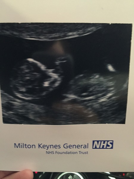 September 2015 (Thread 5) Bring on the scans! :)