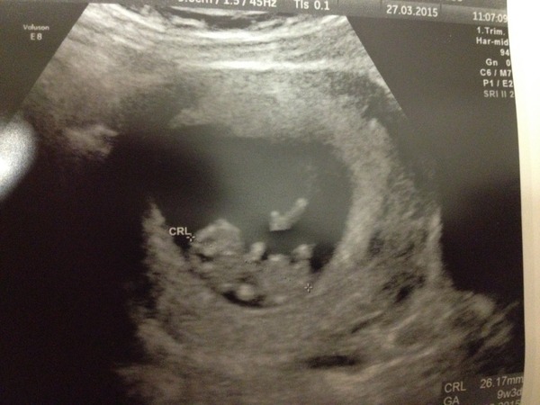 October baby bus take 3- booking in appointments and scans, here we come!