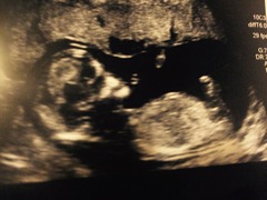 12 weeks + 4 days nub theory